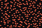 Jitter Storm preset preview