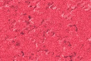 Dense Grain preset preview